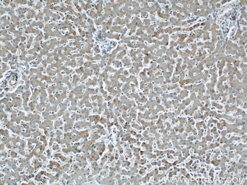 IHC staining of human liver using 12201-1-AP