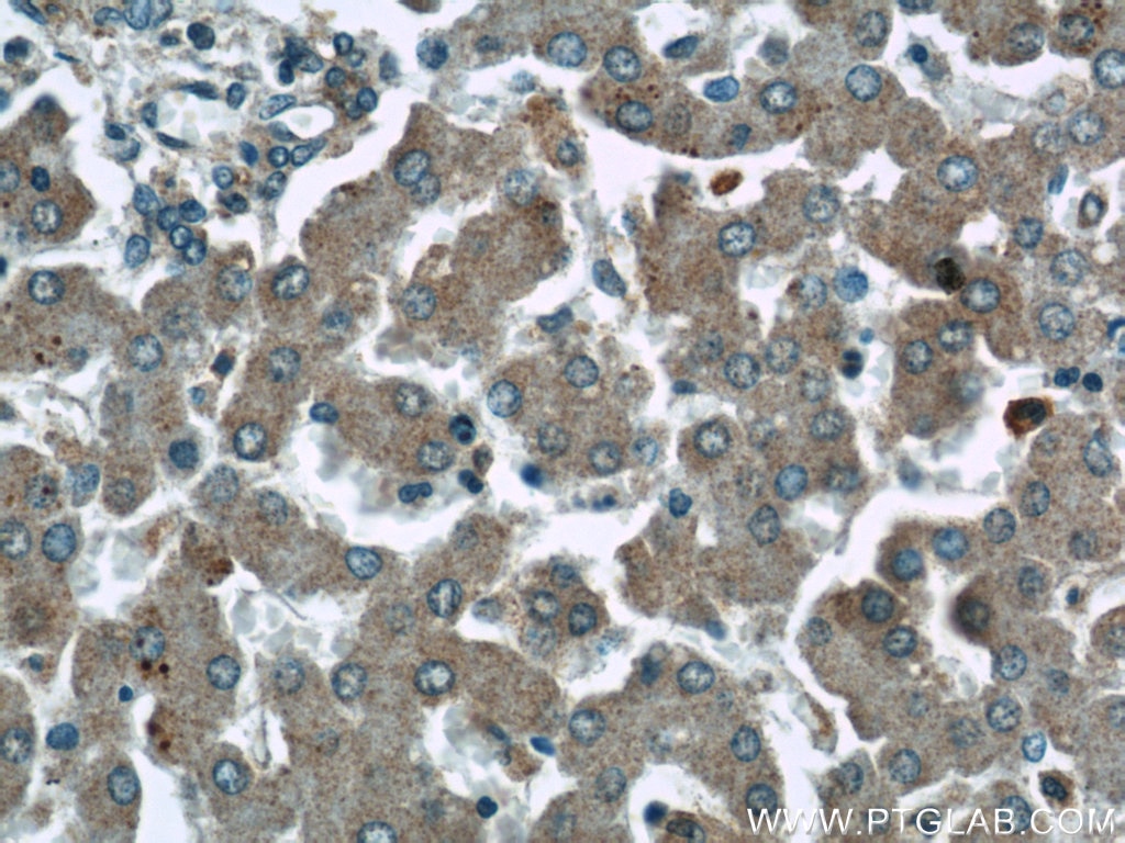 Immunohistochemistry (IHC) staining of human liver tissue using ABHD5 Polyclonal antibody (12201-1-AP)