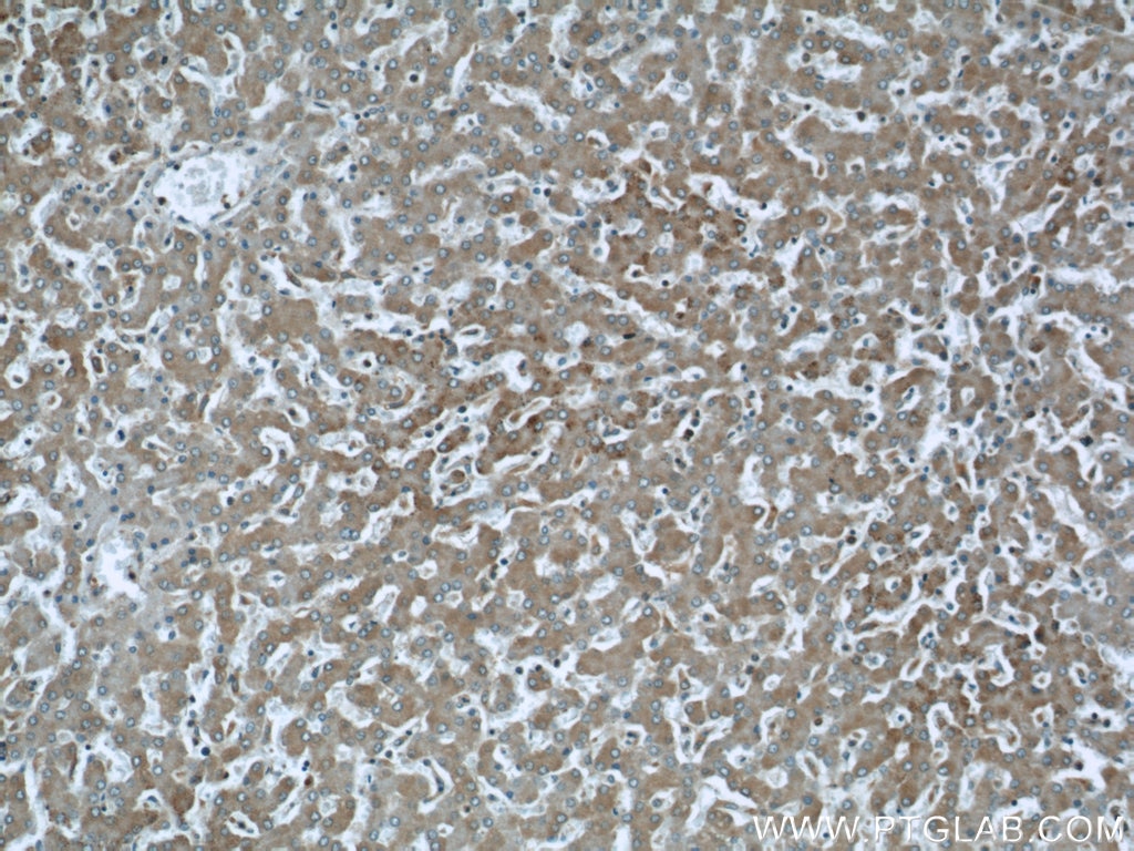 Immunohistochemistry (IHC) staining of human liver tissue using ABHD5 Polyclonal antibody (12201-1-AP)