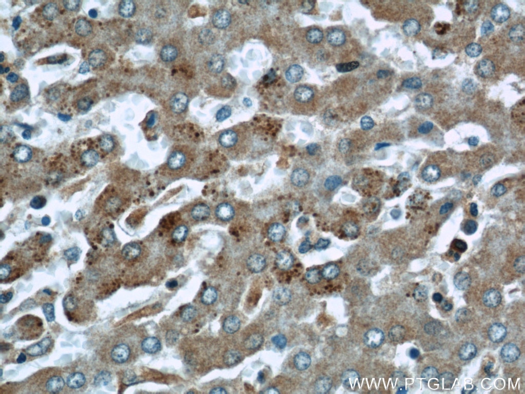 IHC staining of human liver using 12201-1-AP