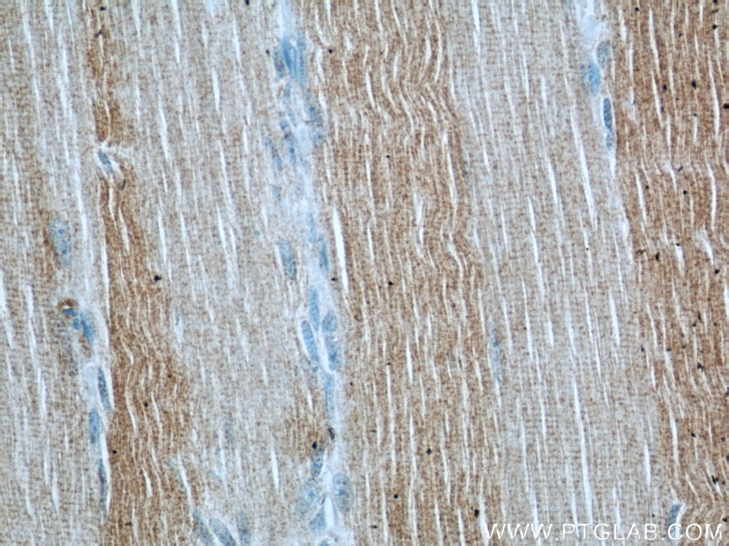 IHC staining of human skeletal muscle using 12201-1-AP