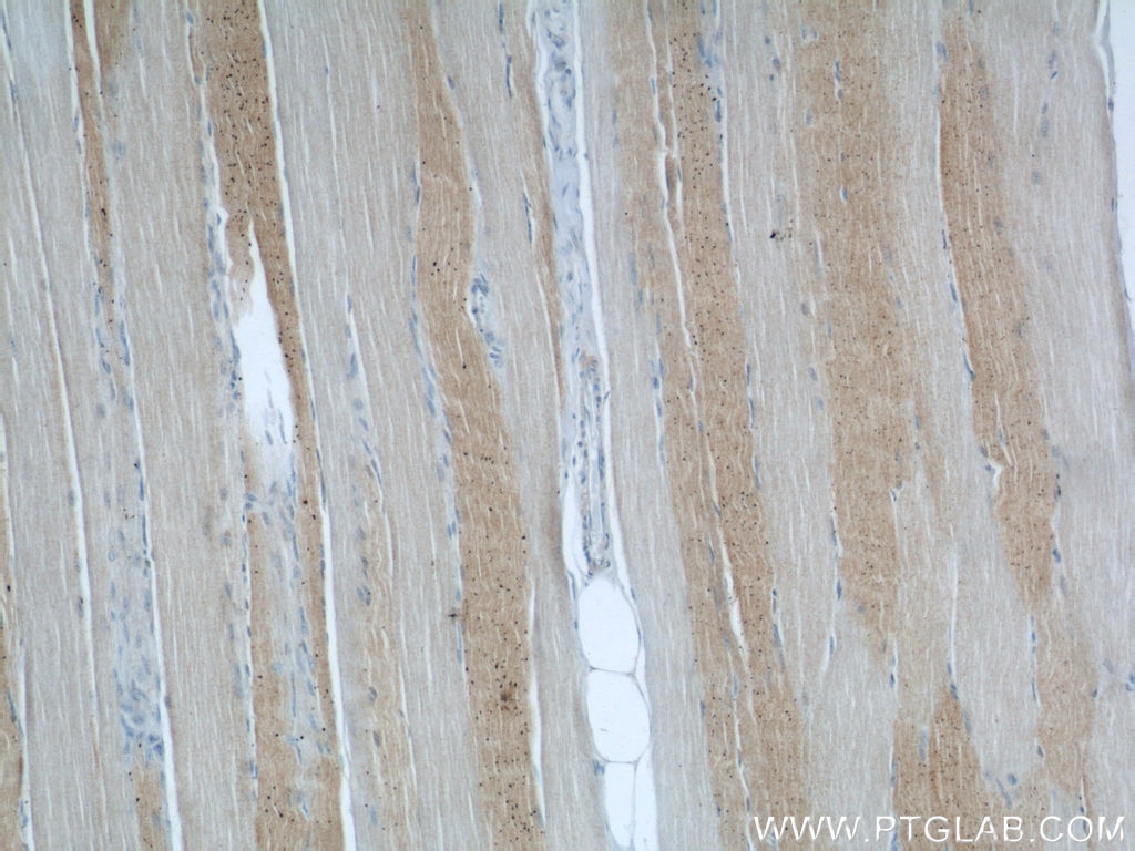 Immunohistochemistry (IHC) staining of human skeletal muscle tissue using ABHD5 Polyclonal antibody (12201-1-AP)