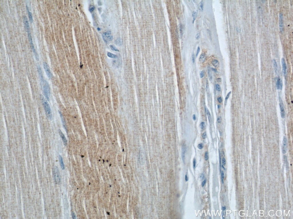 Immunohistochemistry (IHC) staining of human skeletal muscle tissue using ABHD5 Polyclonal antibody (12201-1-AP)