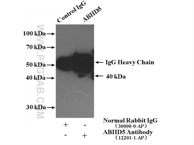Immunoprecipitation (IP) experiment of Jurkat cells using ABHD5 Polyclonal antibody (12201-1-AP)