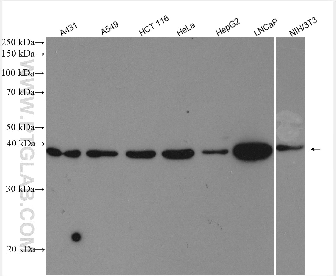 Western Blot (WB) analysis of various lysates using ABHD5 Polyclonal antibody (12201-1-AP)