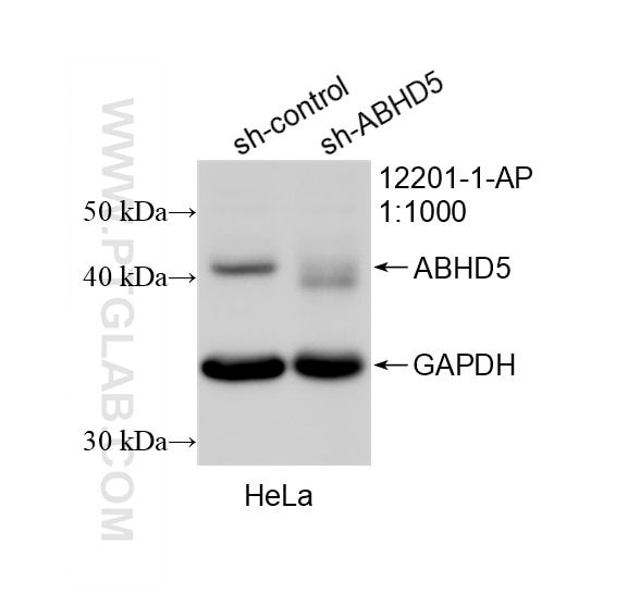 Western Blot (WB) analysis of HeLa cells using ABHD5 Polyclonal antibody (12201-1-AP)