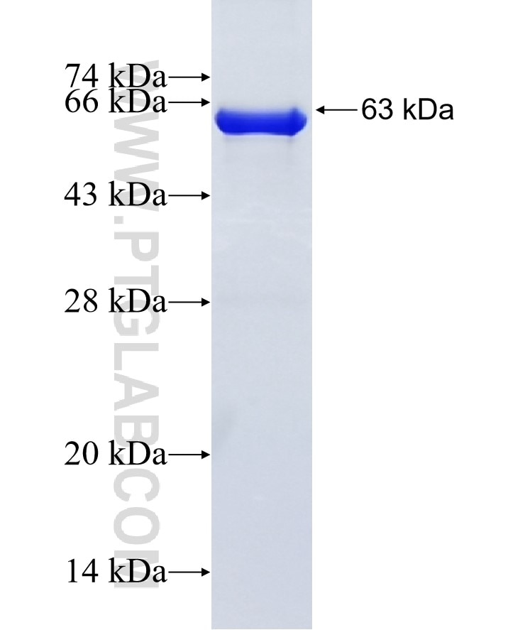 ABHD5 fusion protein Ag2840 SDS-PAGE