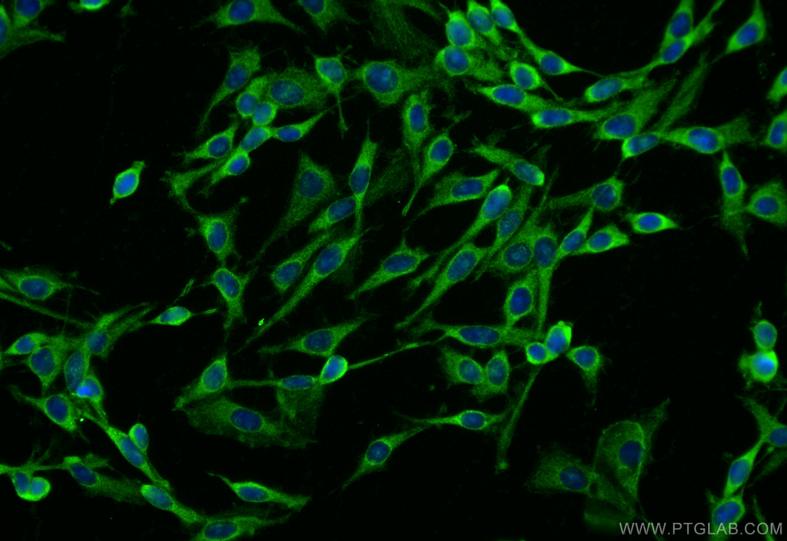 Immunofluorescence (IF) / fluorescent staining of C6 cells using ABHD6 Polyclonal antibody (20494-1-AP)