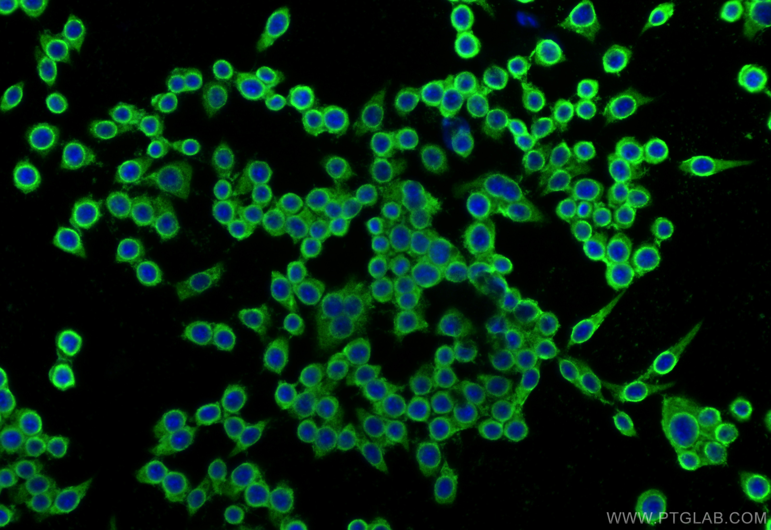 Immunofluorescence (IF) / fluorescent staining of RAW 264.7 cells using ABHD6 Polyclonal antibody (20494-1-AP)