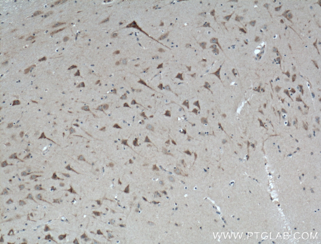 Immunohistochemistry (IHC) staining of human brain tissue using ABHD6 Polyclonal antibody (20494-1-AP)