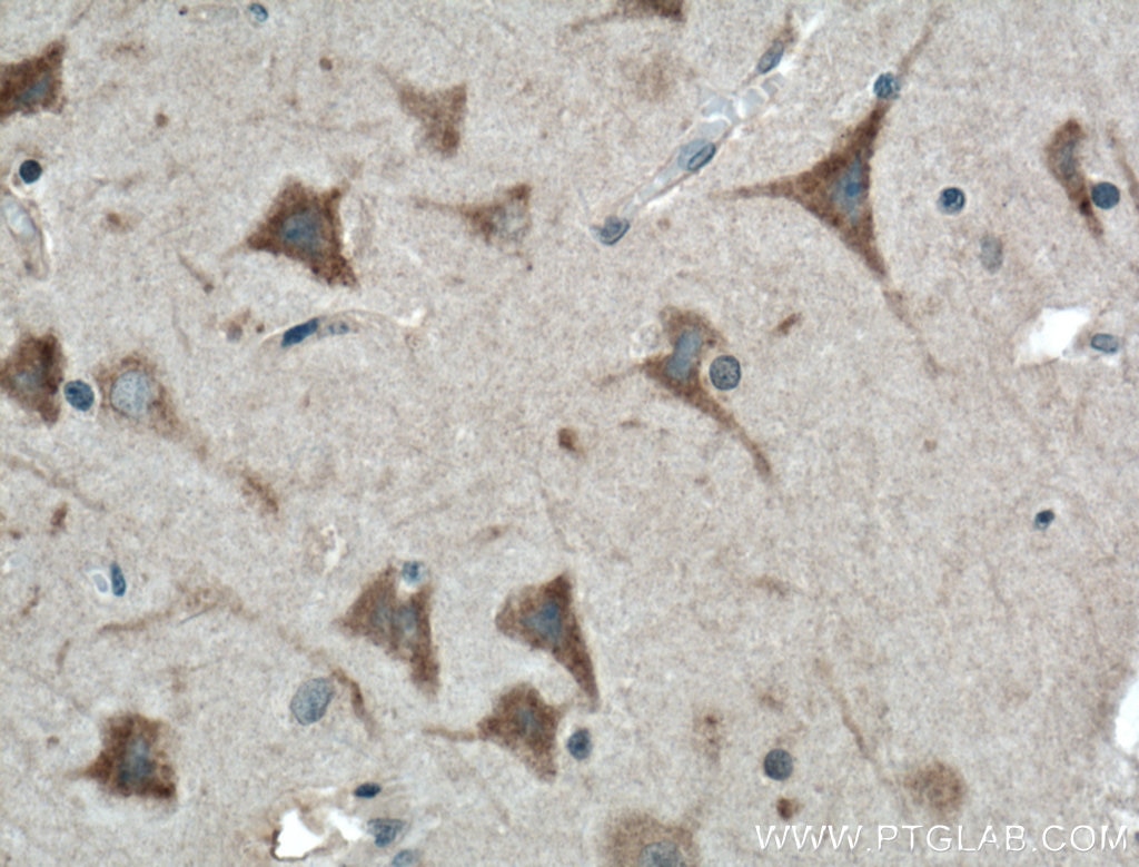 Immunohistochemistry (IHC) staining of human brain tissue using ABHD6 Polyclonal antibody (20494-1-AP)