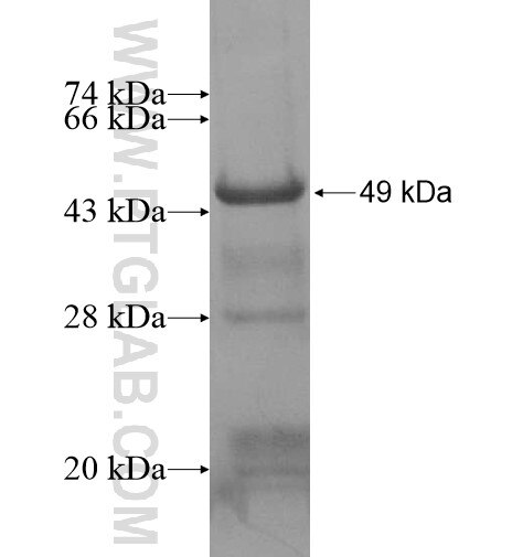 ABHD8 fusion protein Ag14726 SDS-PAGE