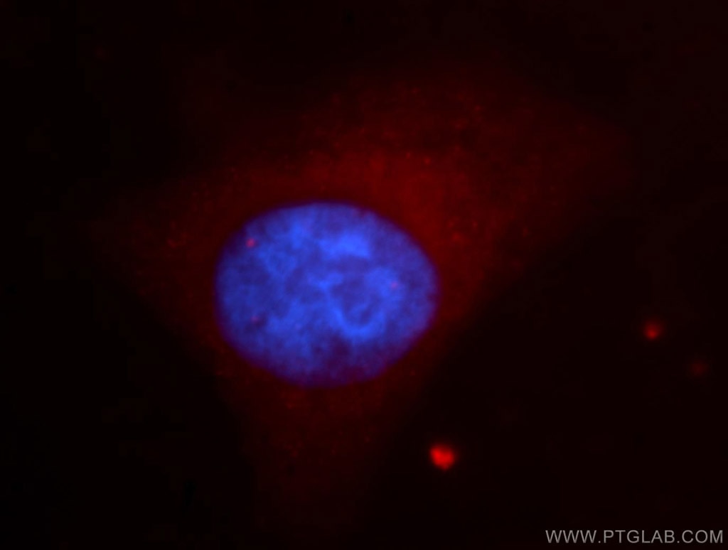 Immunofluorescence (IF) / fluorescent staining of HepG2 cells using ABI1 Polyclonal antibody (11516-1-AP)