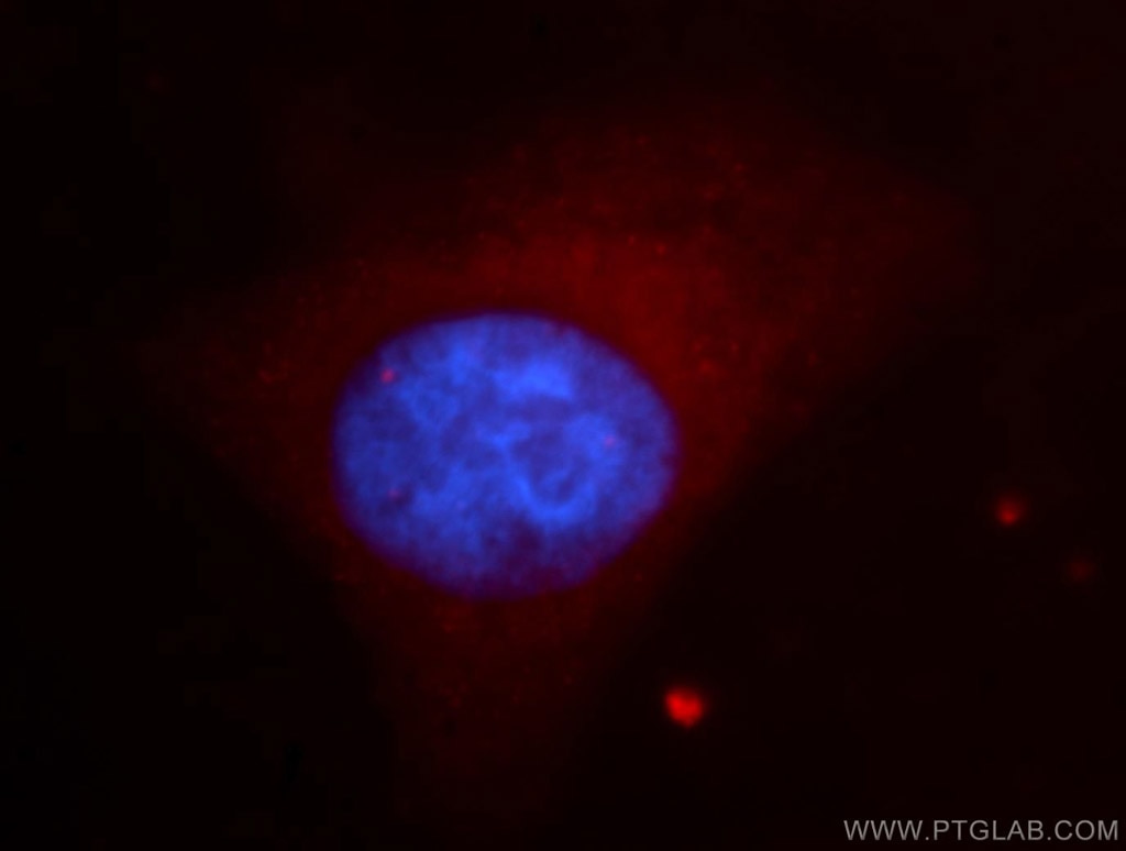 IF Staining of HepG2 using 11516-1-AP