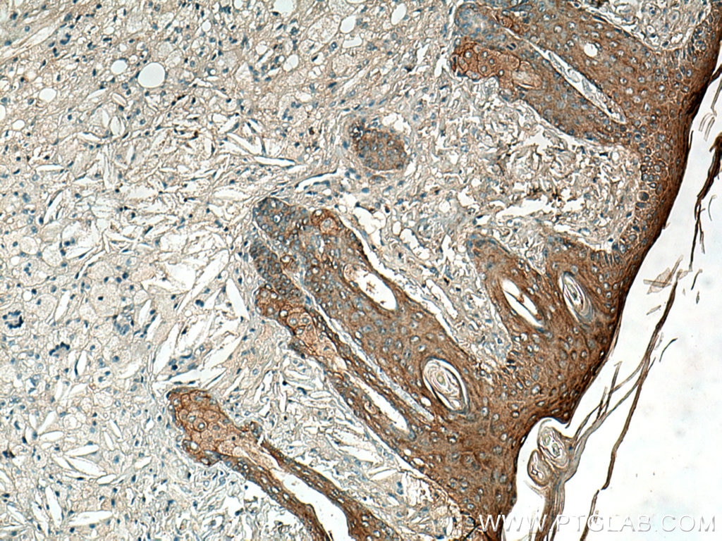 Immunohistochemistry (IHC) staining of mouse skin tissue using ABI1 Polyclonal antibody (27387-1-AP)