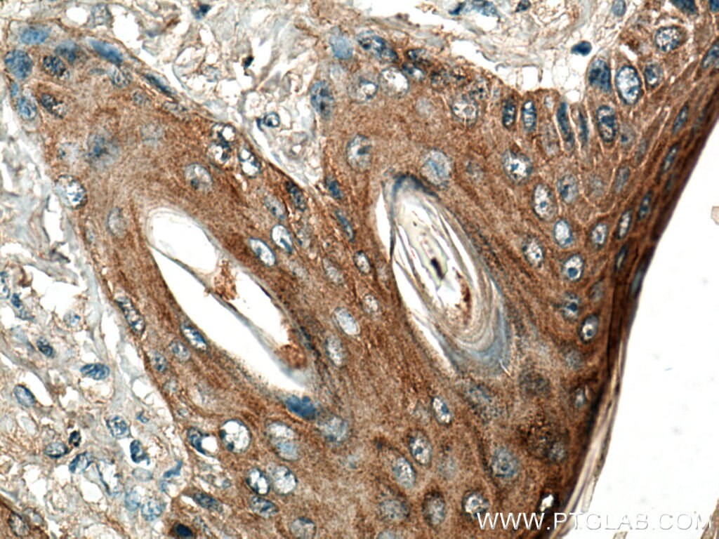 Immunohistochemistry (IHC) staining of mouse skin tissue using ABI1 Polyclonal antibody (27387-1-AP)