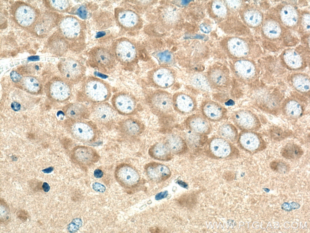 Immunohistochemistry (IHC) staining of mouse brain tissue using ABI1 Polyclonal antibody (27387-1-AP)