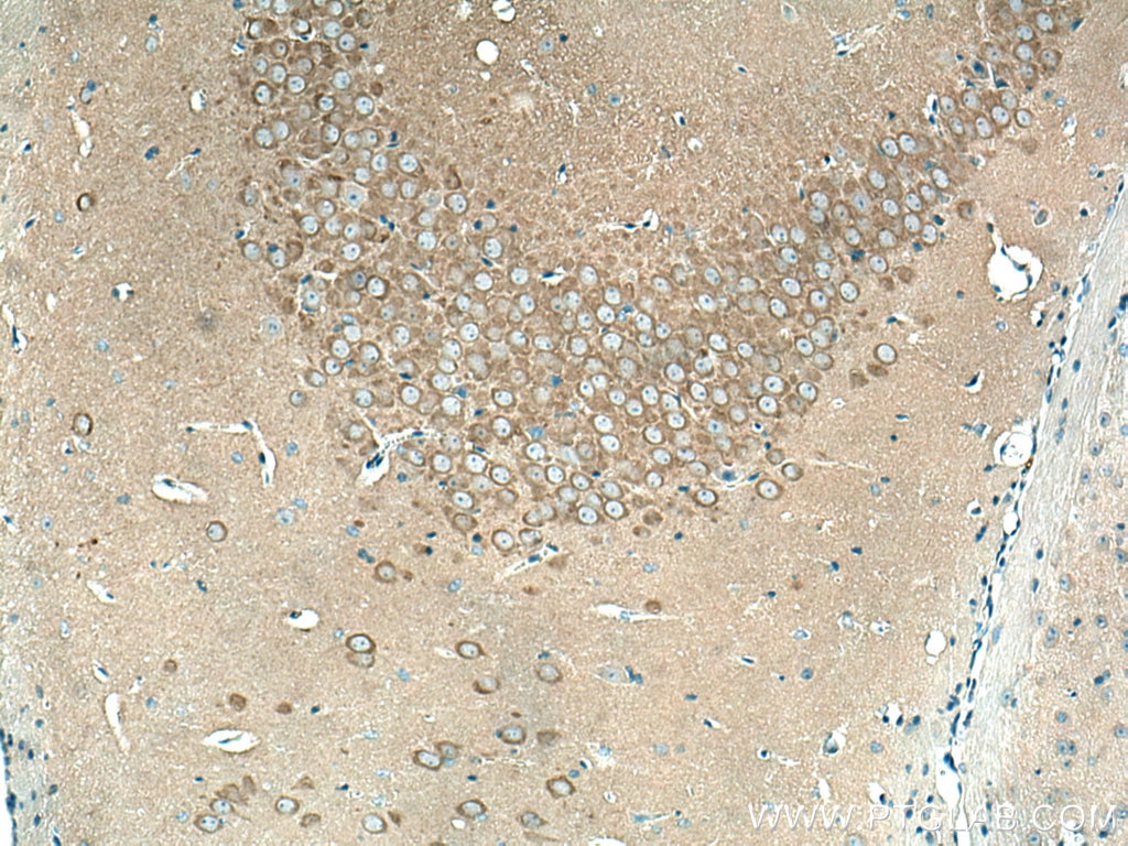 Immunohistochemistry (IHC) staining of mouse brain tissue using ABI1 Polyclonal antibody (27387-1-AP)