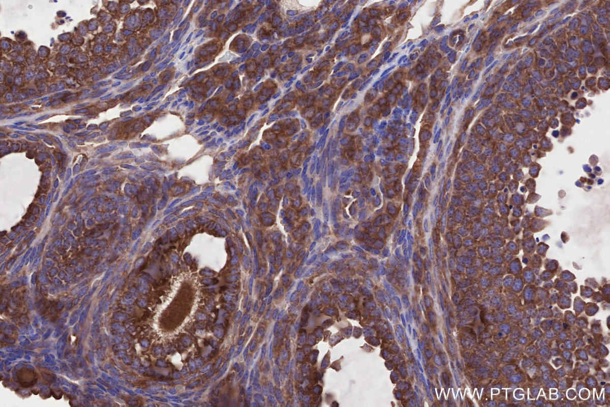 Immunohistochemistry (IHC) staining of mouse ovary tissue using ABI1 Polyclonal antibody (27387-1-AP)