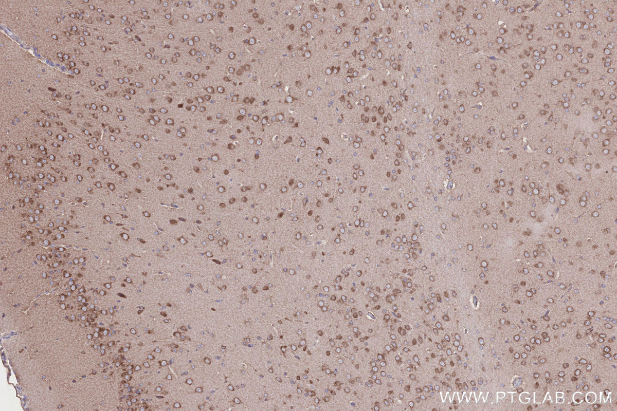 Immunohistochemistry (IHC) staining of rat brain tissue using ABI1 Polyclonal antibody (27387-1-AP)