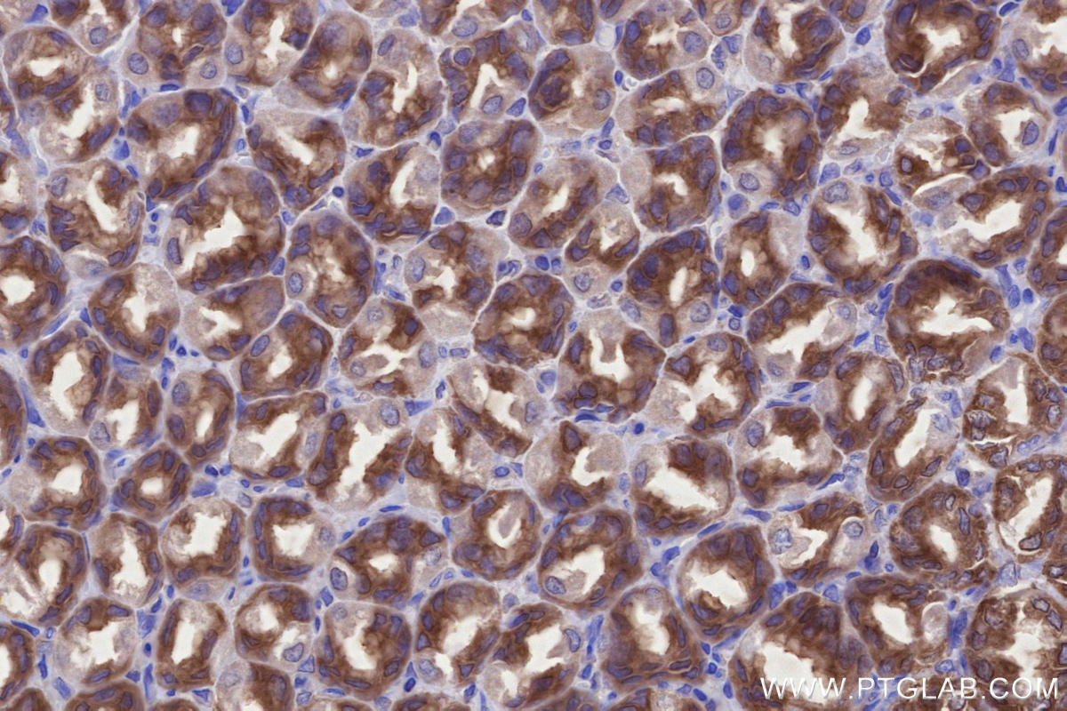 Immunohistochemistry (IHC) staining of rat stomach tissue using ABI1 Polyclonal antibody (27387-1-AP)