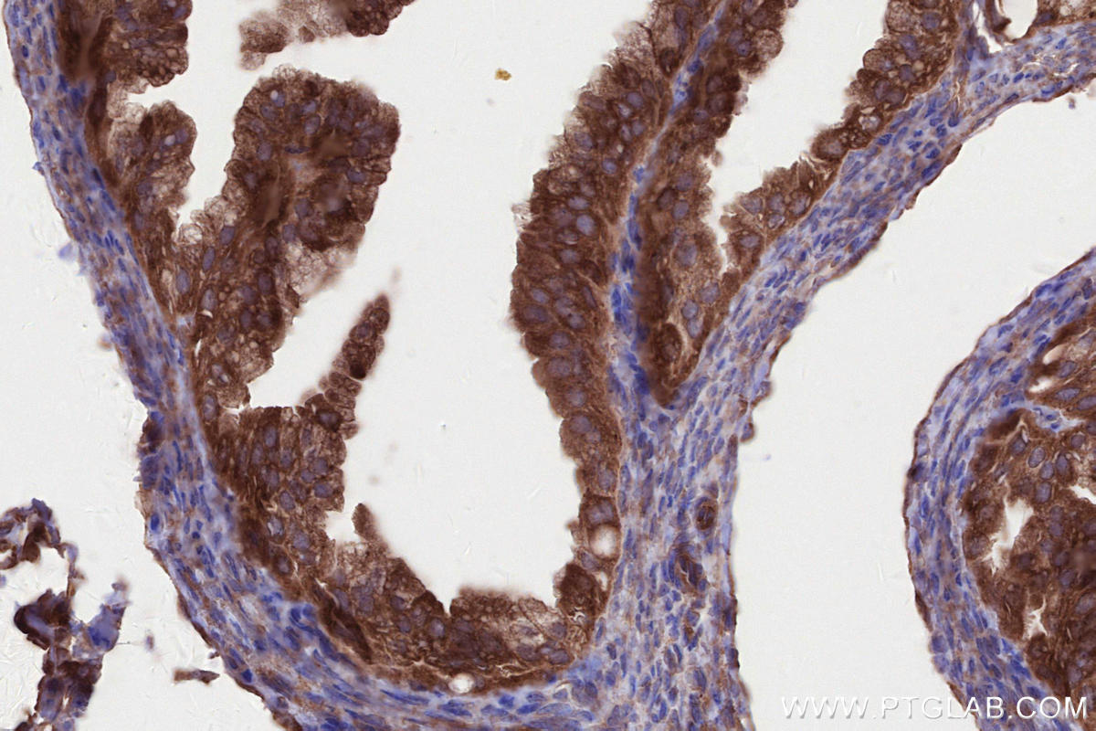 Immunohistochemistry (IHC) staining of mouse ovary tissue using ABI1 Polyclonal antibody (27387-1-AP)