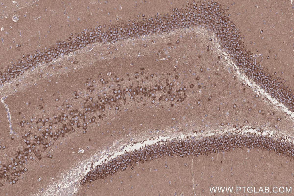 Immunohistochemistry (IHC) staining of rat brain tissue using ABI1 Polyclonal antibody (27387-1-AP)