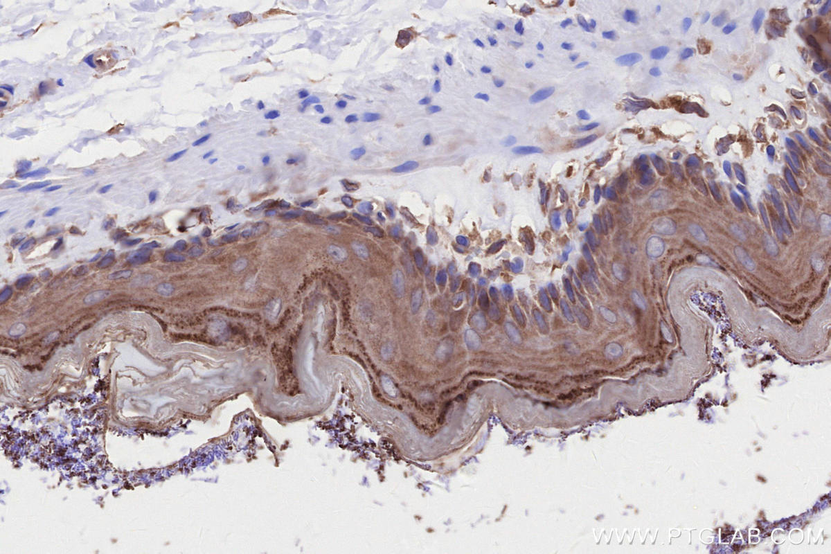 Immunohistochemistry (IHC) staining of rat stomach tissue using ABI1 Polyclonal antibody (27387-1-AP)