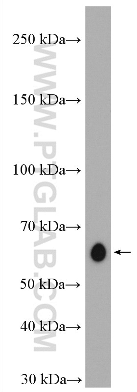 Western Blot (WB) analysis of MCF-7 cells using ABI1 Polyclonal antibody (27387-1-AP)