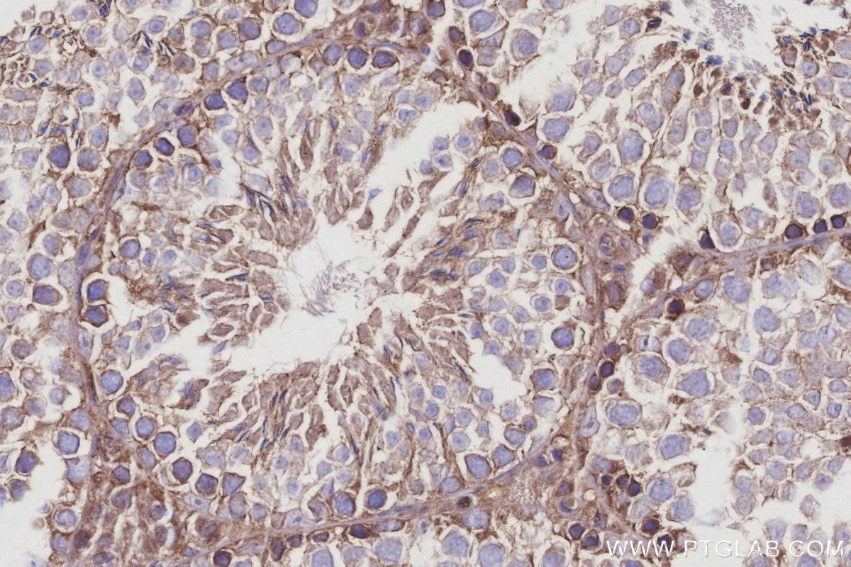 Immunohistochemistry (IHC) staining of mouse testis tissue using ABI2 Polyclonal antibody (14890-1-AP)