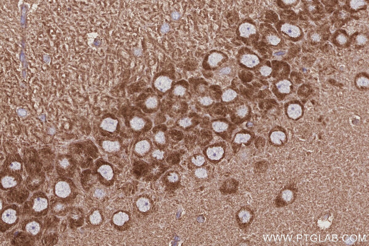 Immunohistochemistry (IHC) staining of rat brain tissue using ABI2 Polyclonal antibody (14890-1-AP)
