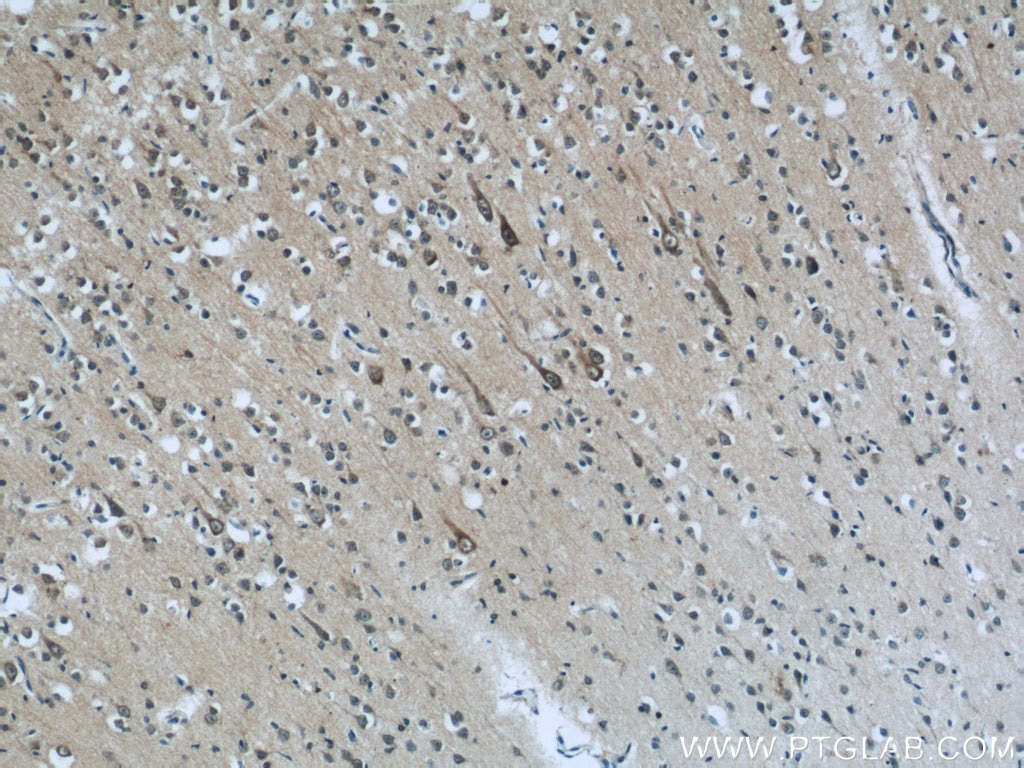 Immunohistochemistry (IHC) staining of human brain tissue using ABI2 Polyclonal antibody (14890-1-AP)