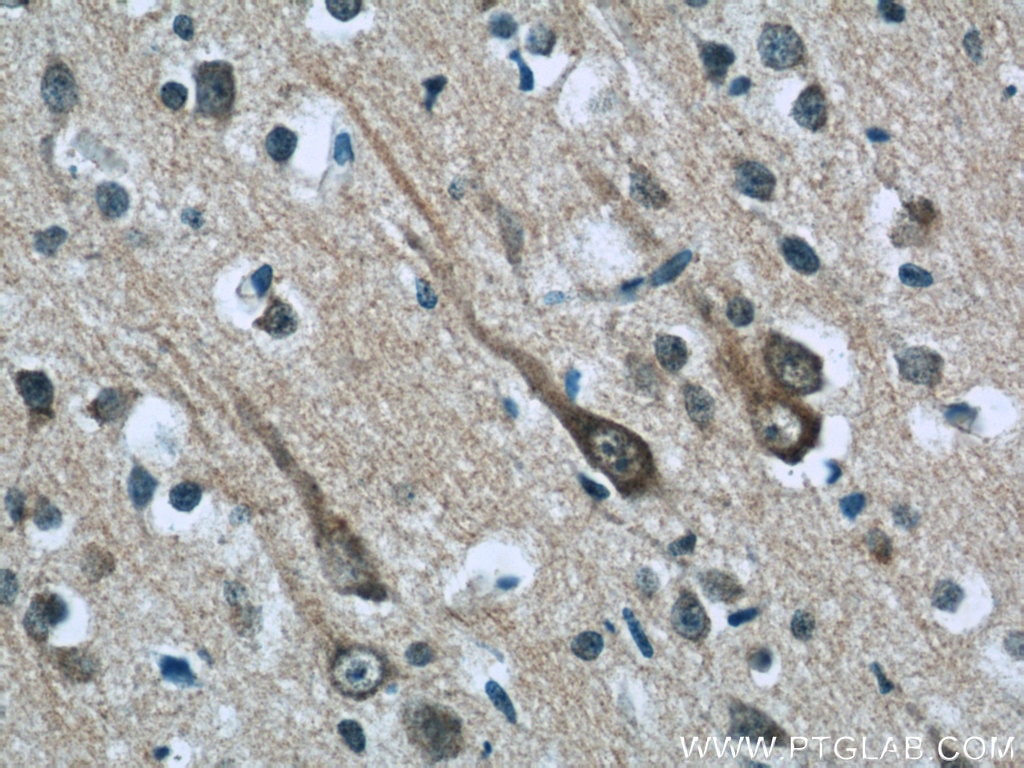Immunohistochemistry (IHC) staining of human brain tissue using ABI2 Polyclonal antibody (14890-1-AP)
