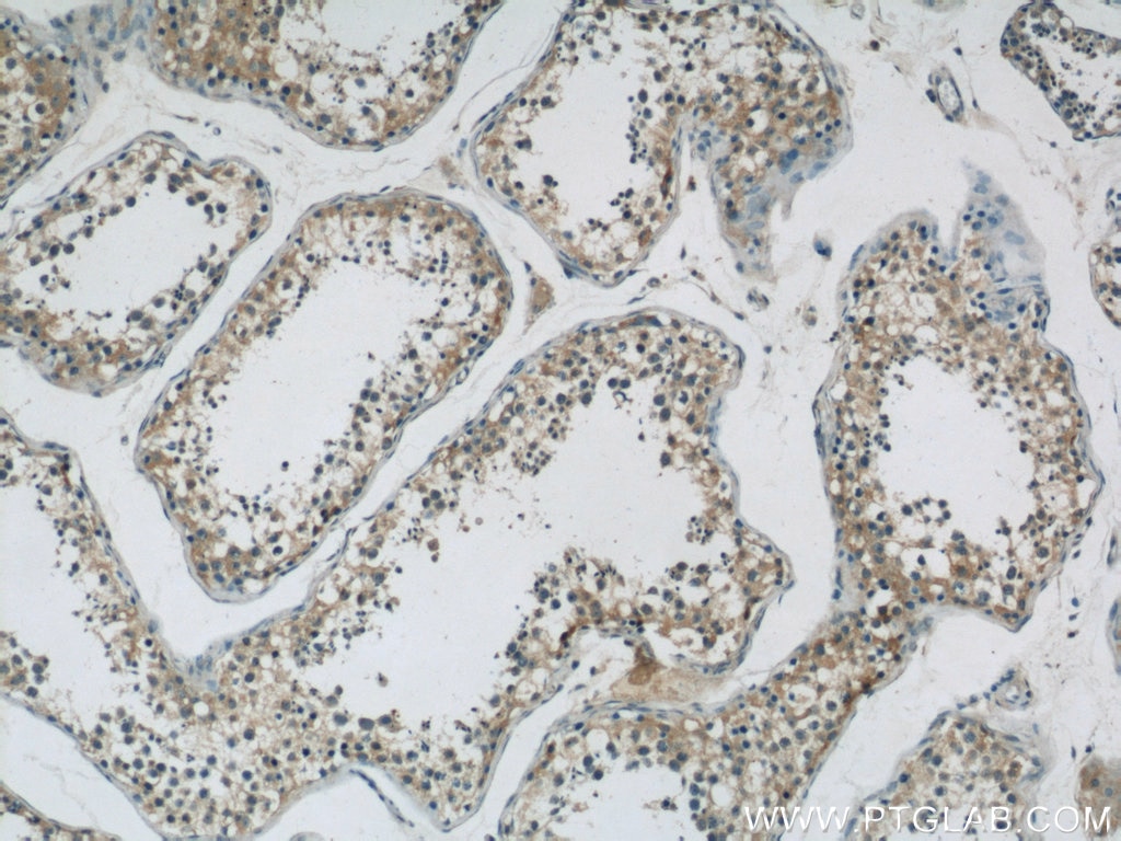 IHC staining of human testis using 14890-1-AP