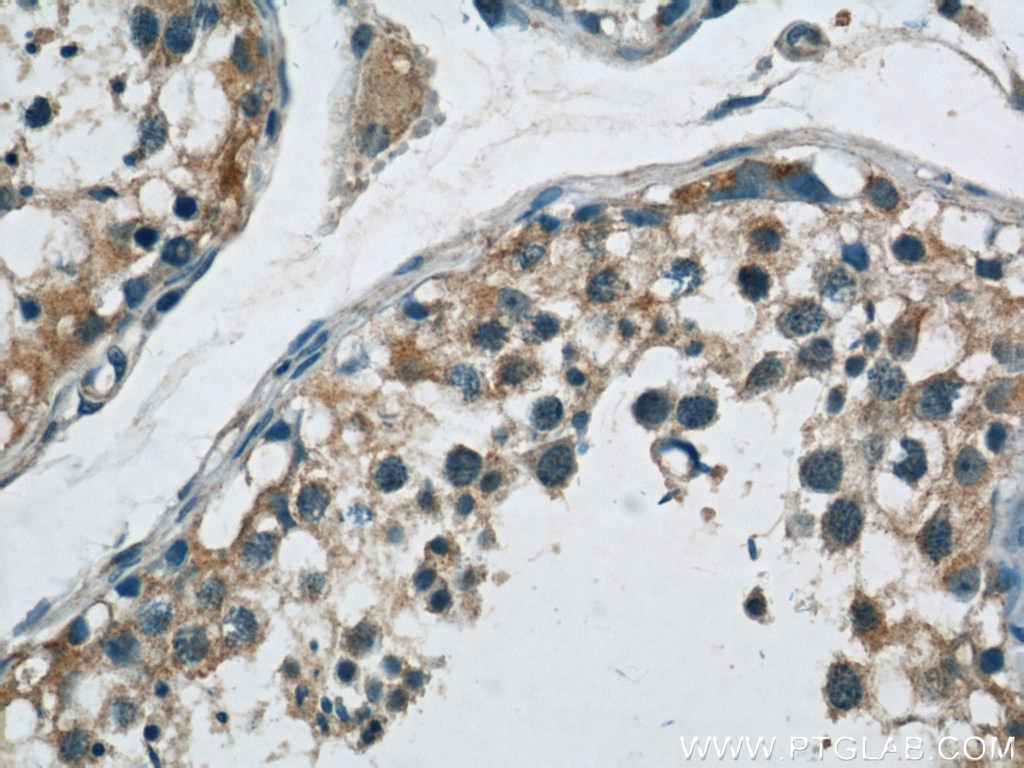Immunohistochemistry (IHC) staining of human testis tissue using ABI2 Polyclonal antibody (14890-1-AP)