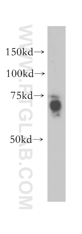 Western Blot (WB) analysis of mouse brain tissue using ABI2 Polyclonal antibody (14890-1-AP)