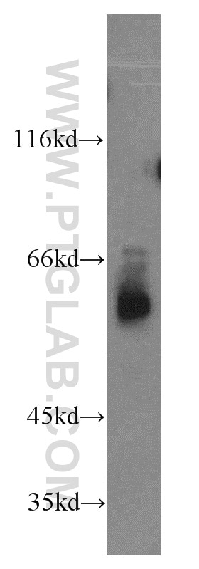Western Blot (WB) analysis of mouse heart tissue using ABI2 Polyclonal antibody (14890-1-AP)
