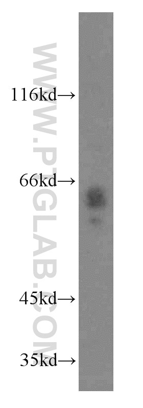Western Blot (WB) analysis of mouse uterus tissue using ABI2 Polyclonal antibody (14890-1-AP)