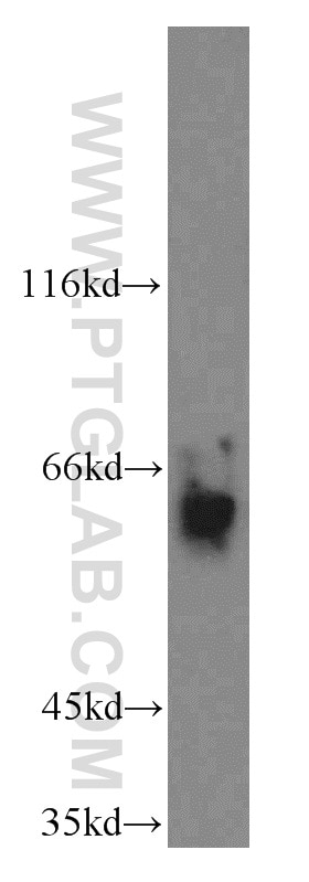 Western Blot (WB) analysis of HEK-293 cells using ABI2 Polyclonal antibody (14890-1-AP)
