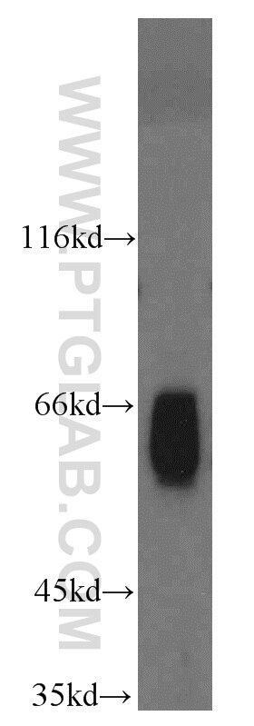 Western Blot (WB) analysis of mouse testis tissue using ABI2 Polyclonal antibody (14890-1-AP)