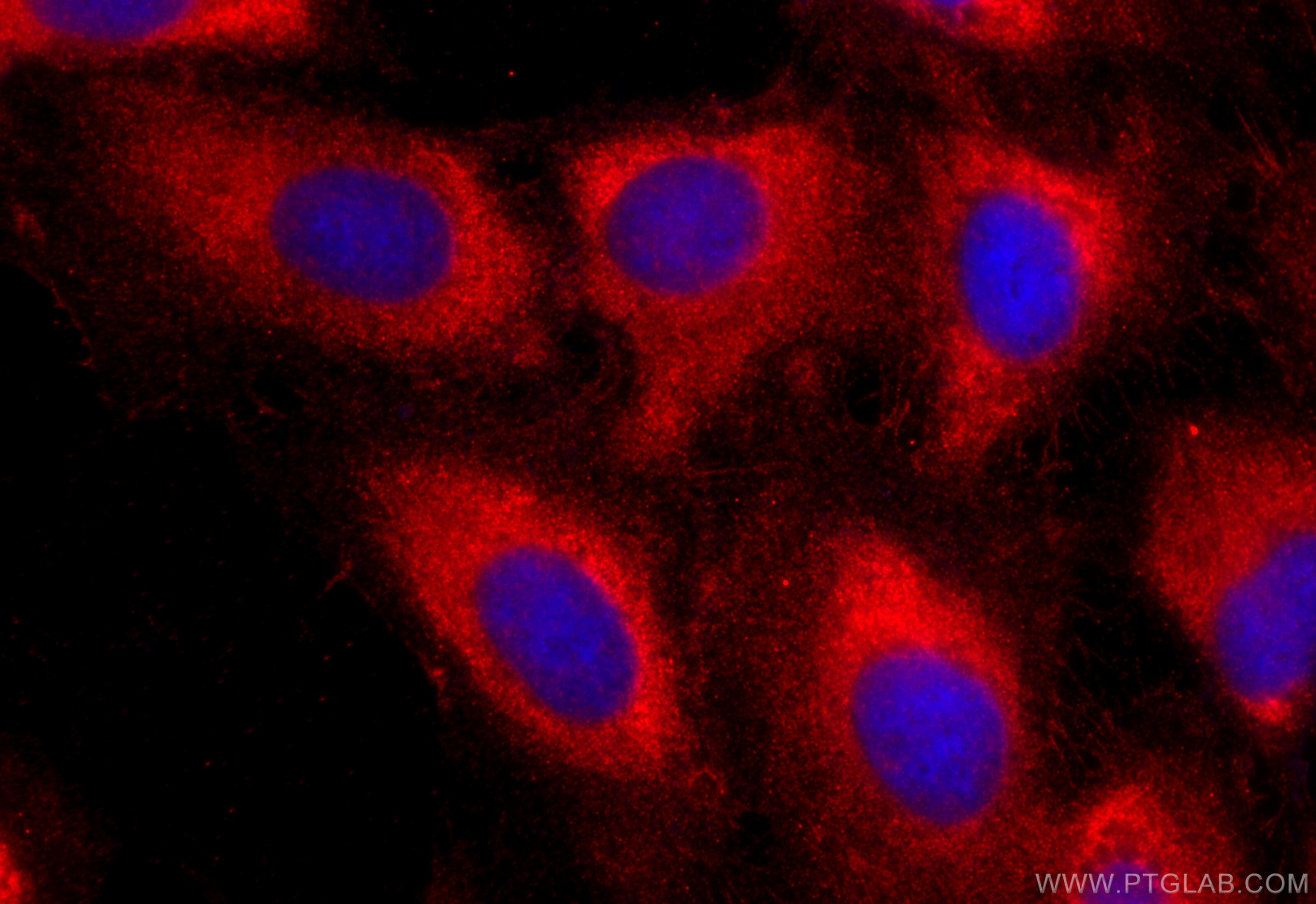 Immunofluorescence (IF) / fluorescent staining of U2OS cells using ABI3 Polyclonal antibody (16227-1-AP)