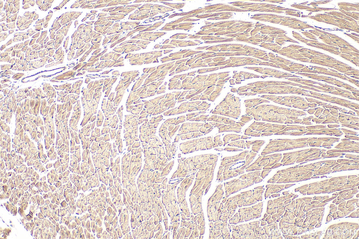 Immunohistochemistry (IHC) staining of mouse heart tissue using ABI3 Polyclonal antibody (16227-1-AP)