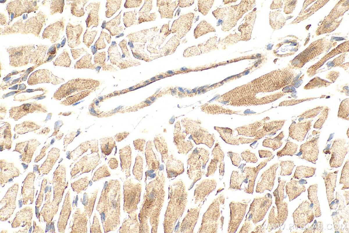 Immunohistochemistry (IHC) staining of mouse heart tissue using ABI3 Polyclonal antibody (16227-1-AP)
