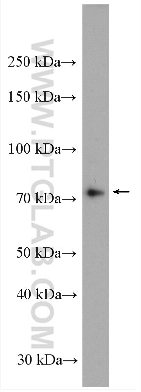 Western Blot (WB) analysis of mouse thymus tissue using ABI3BP Polyclonal antibody (27727-1-AP)