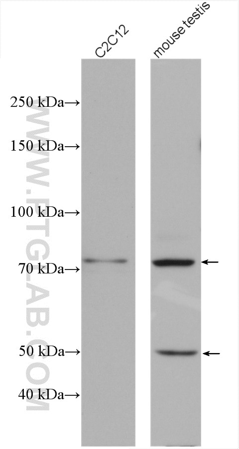 Western Blot (WB) analysis of various lysates using ABI3BP Polyclonal antibody (27727-1-AP)