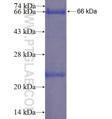 ABI3BP fusion protein Ag3877 SDS-PAGE