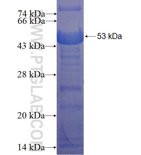 ABI3BP fusion protein Ag4408 SDS-PAGE