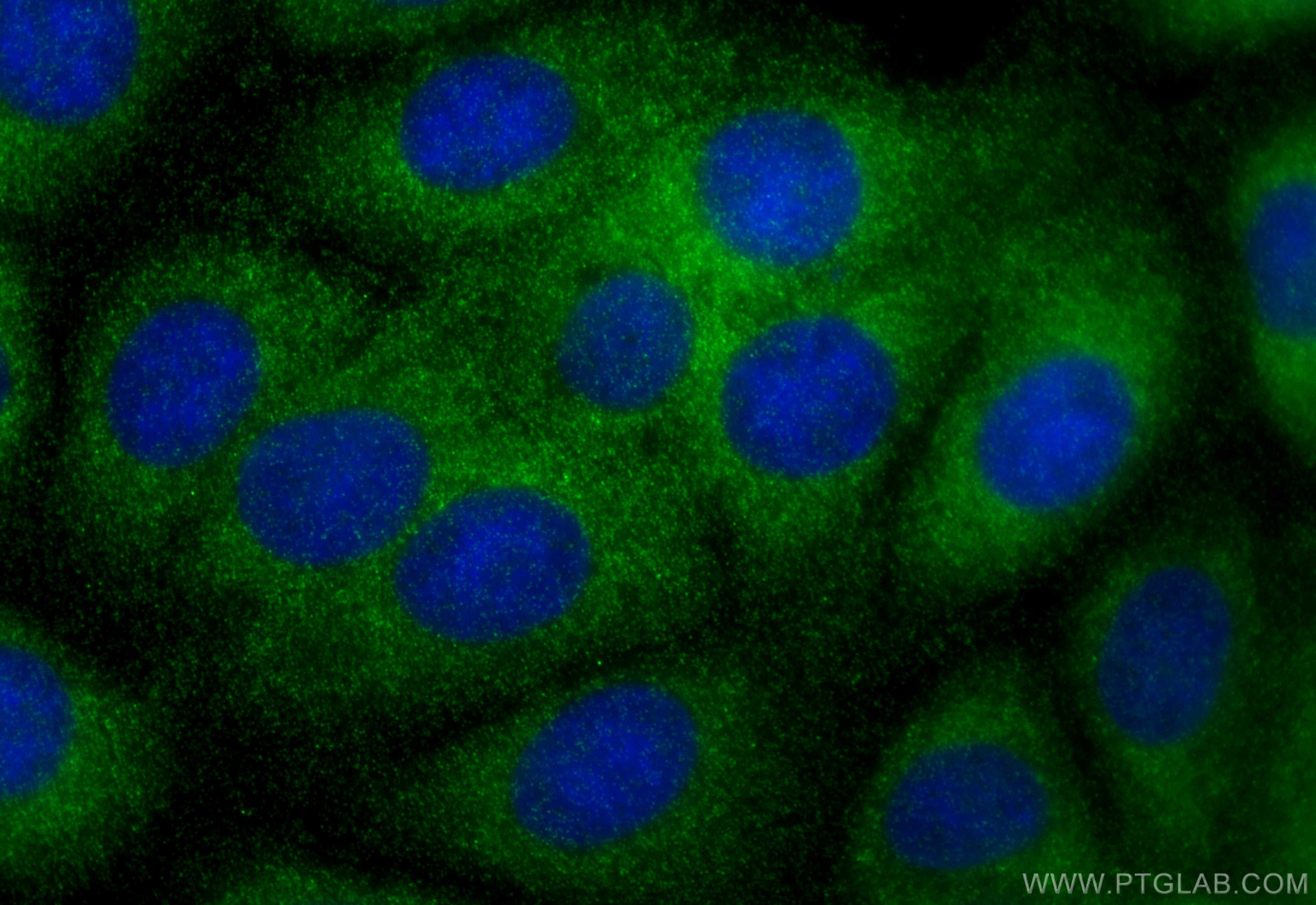 Immunofluorescence (IF) / fluorescent staining of MCF-7 cells using ABL1 Polyclonal antibody (32207-1-AP)