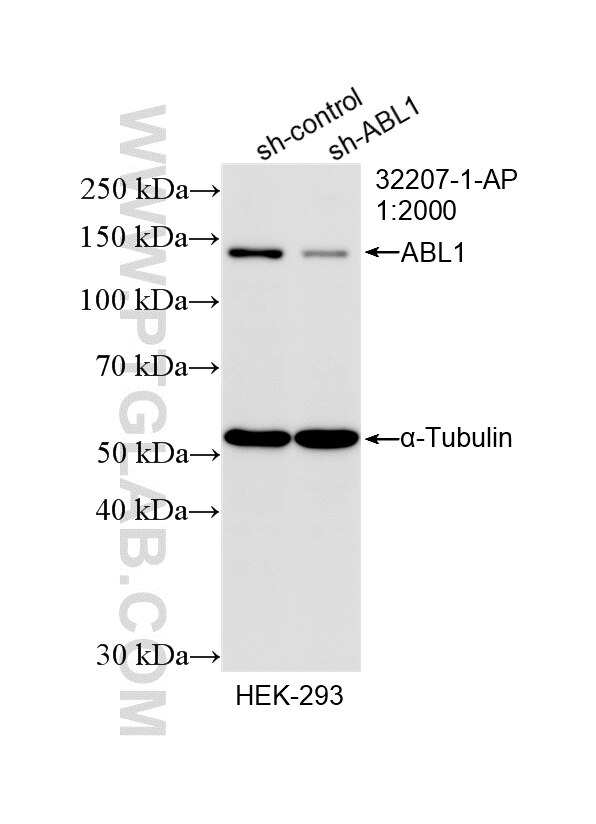 Western Blot (WB) analysis of HEK-293 cells using ABL1 Polyclonal antibody (32207-1-AP)