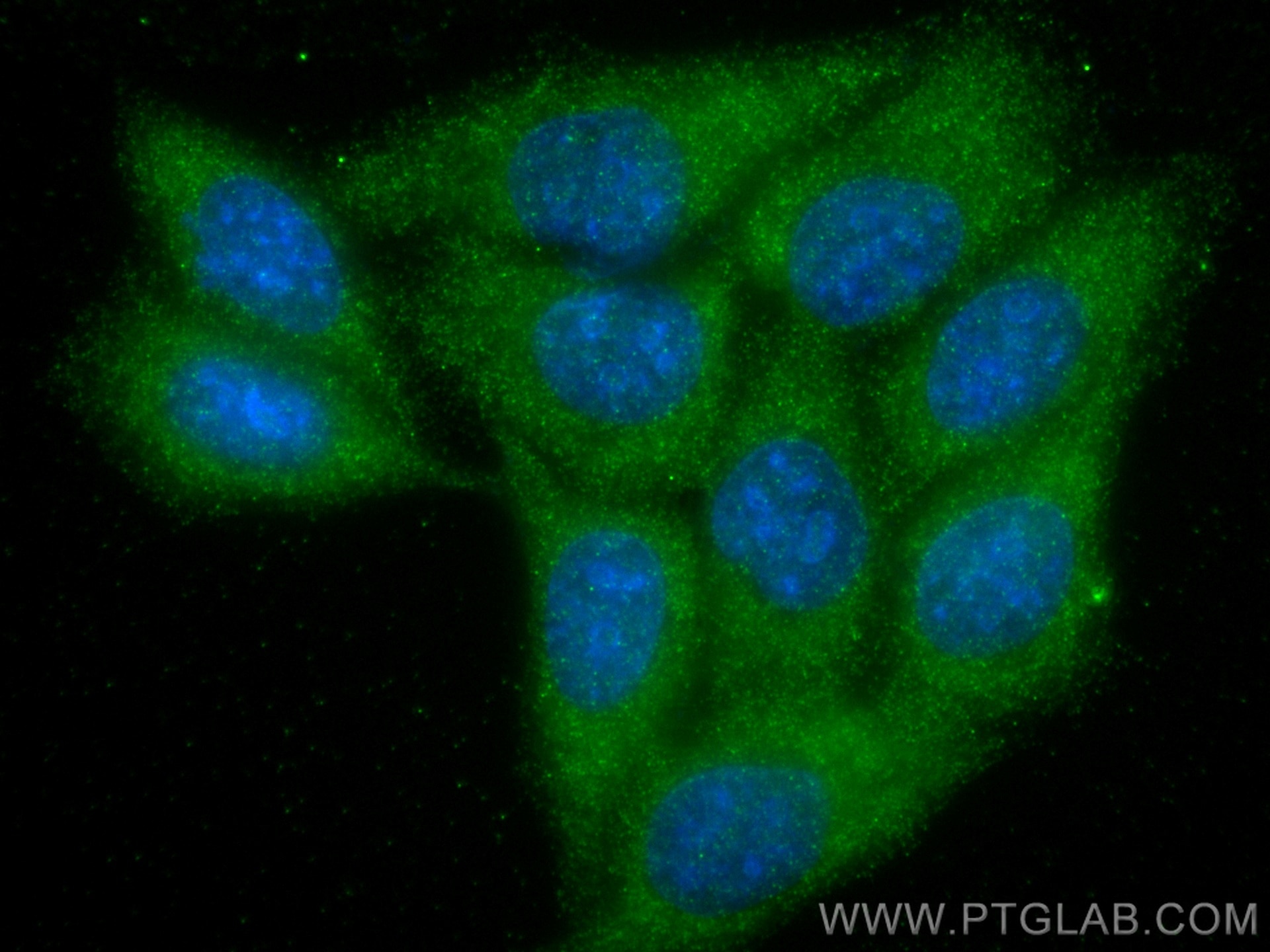 Immunofluorescence (IF) / fluorescent staining of HepG2 cells using ABL1 Monoclonal antibody (68254-1-Ig)